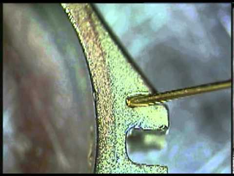 Sisma LM repairing laser