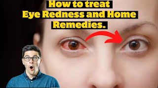 Bloodshot Eyes  What to do? How to treat Eye Redness and Home Remedies.,