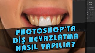 Adobe Photoshop Diş Beyazlatma Resimli Anlatım 2. Ders