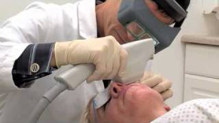 Skin care laser treatments for sun spots & age spots