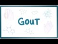 Gout - causes, symptoms, diagnosis, treatment, pathology