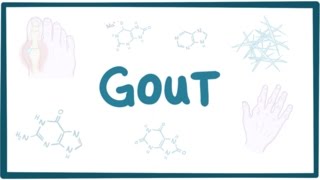 Gout - Causes, Symptoms, Diagnosis, Treatment, Pathology