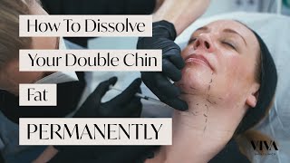 How to Dissolve your Double Chin Fat PERMANENTLY 😍