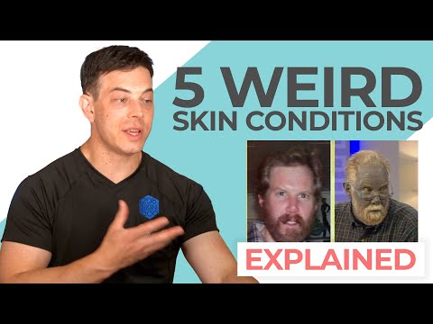Crazy Skin Conditions - Dermatologist Reacts | 208SkinDoc | Dr. Dustin Portela