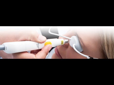 Introducing IPL Lumenis Optilight - Revolutionary Dry Eye treatment at Village Optics