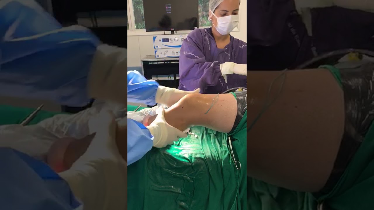 Thiago Ildefonso Dornellas Torres-24