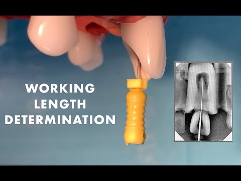 Preclinical Laboratory Dentistry - Working Length Determination