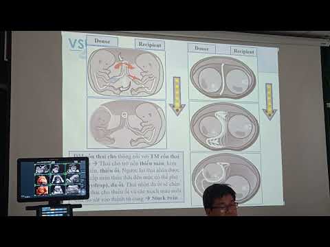 Song thai 1 nhau p2 - Bs.Trọng