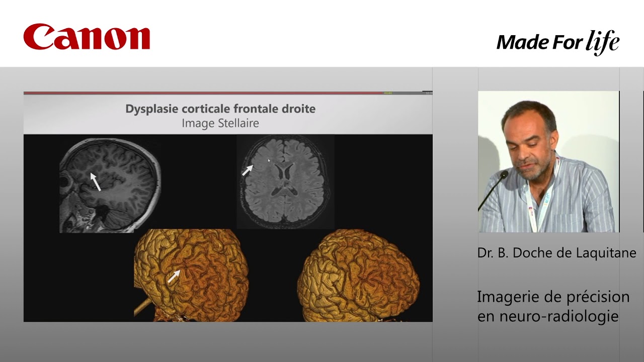 Imagerie de pre?cision en neuro radiologie