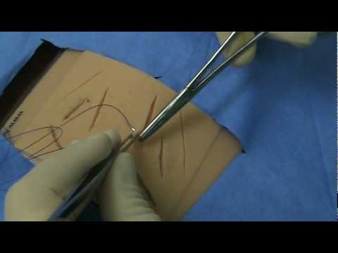 Simple Interrupted Suturing Technique [Tulane Medicine]