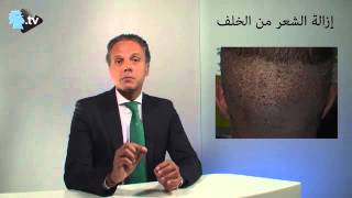 Hair loss solutions on annahar webtv