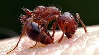 DIY Fire Ant Bite & Sting Home Remedy Treatment