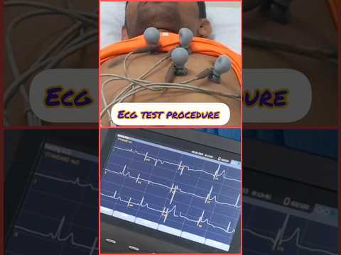 How to perform an ECG #shorts #medical #ecg