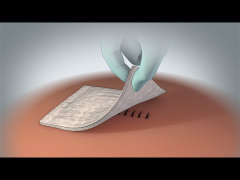 Dolore nella parte sinistra di schiena Posture yoga se il mal di schiena