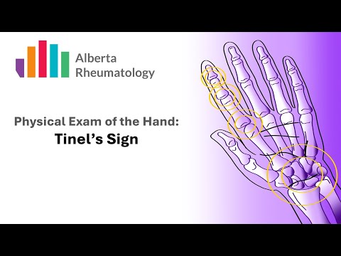 Rheumatology HAND exam: Tinel's Sign for Carpal Tunnel Syndrome