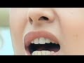 Actress Swathi Reddy Nose And Lips Closeup Ultra Zoom