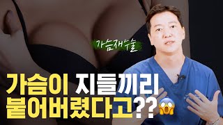 가슴재수술; 가슴합체증 해결법!