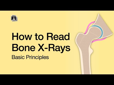 How to Read Bone X-Rays