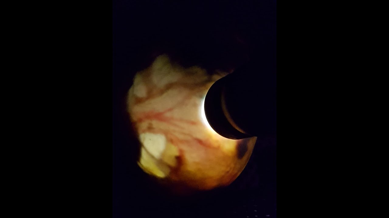 YouTube Short thumbnail