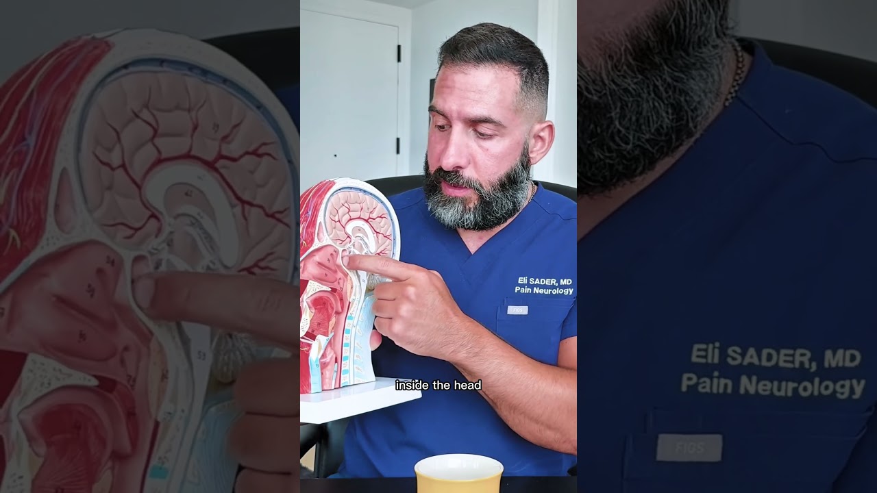 sinus headache..are you sure? #sinusheadache #headache