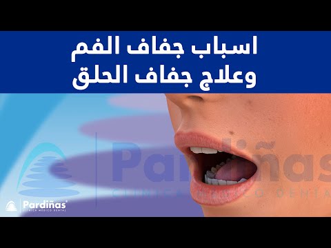 © اسباب جفاف الفم وعلاج جفاف الحلق
