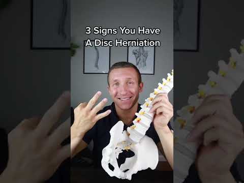 3 Signs You Have A Disc Herniation!