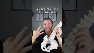 3 Signs You Have A Disc Herniation!