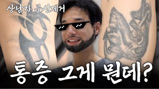 통증 없던데요...? 상남자의 문신지우기