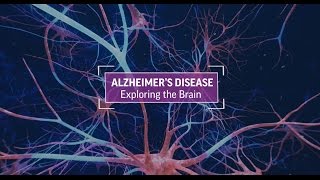 Alzheimer's Disease: Exploring The Brain
