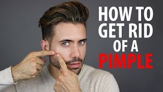 How To Get Rid of a Pimple Overnight | Fast Pimple and Acne Treatments | Alex Costa