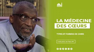 Types et formes de chirk