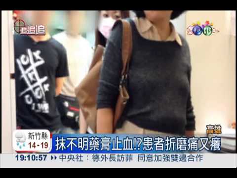 美容院獨門除痣?! 患者拔肉受罪