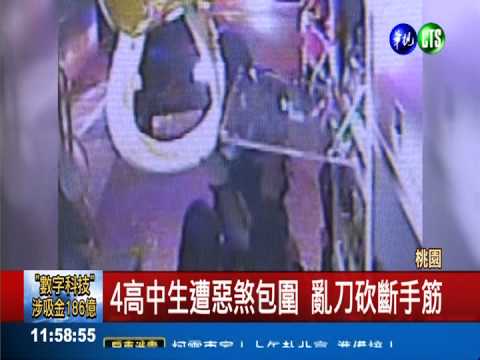 幫派鬥毆認錯人? 高中生遭斷手筋