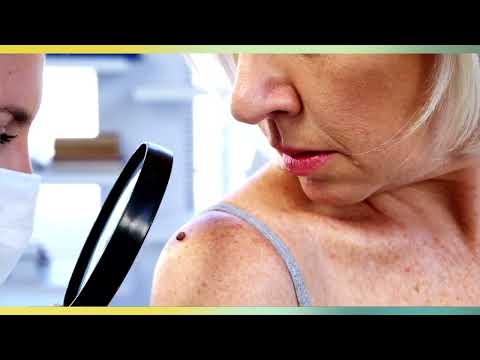 Skin Cancer Interview