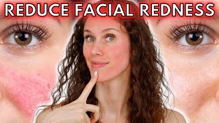 🔴 5 Reasons Your Face Is Always Red (Rosacea to Dermatographia & Everything In-between!)