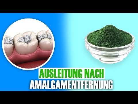 Amalgam raus – und jetzt? Die richtige Ausleitung nach der Entfernung!