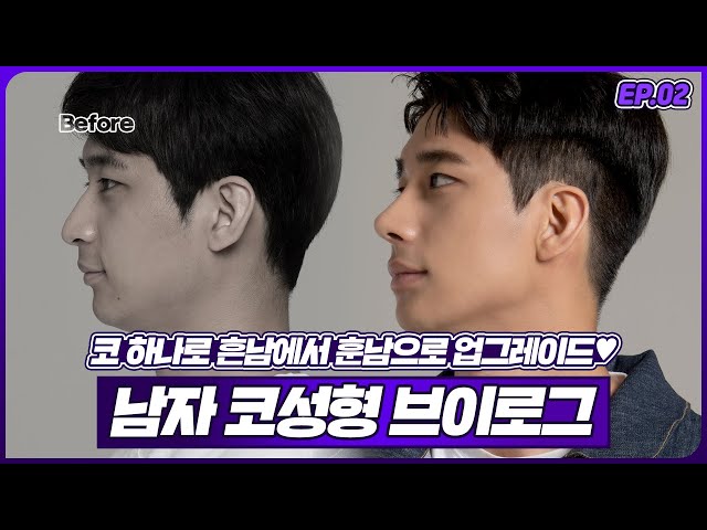 제이티성형외과-예쁜 티 나면, 제이티_병원소개_JT TV 제이티성형외과-예쁜 티 나면, 제이티_병원소개_Jt Tv