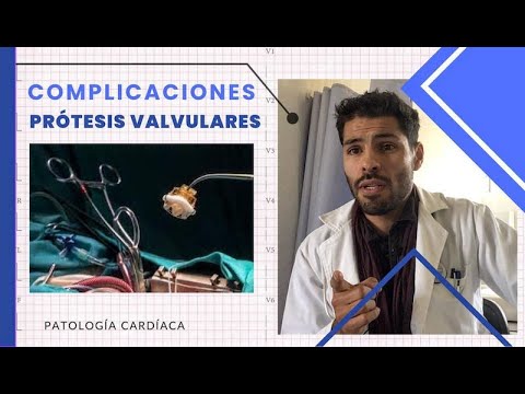 Cardiac Pathology video 6