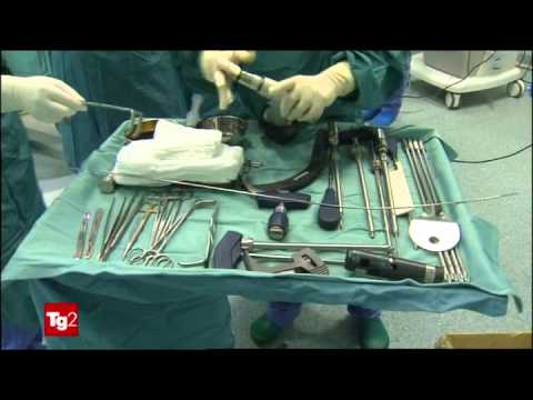 Temperatura osteocondrosi può essere la temperatura 37 Ecografia articolazioni dellanca libro