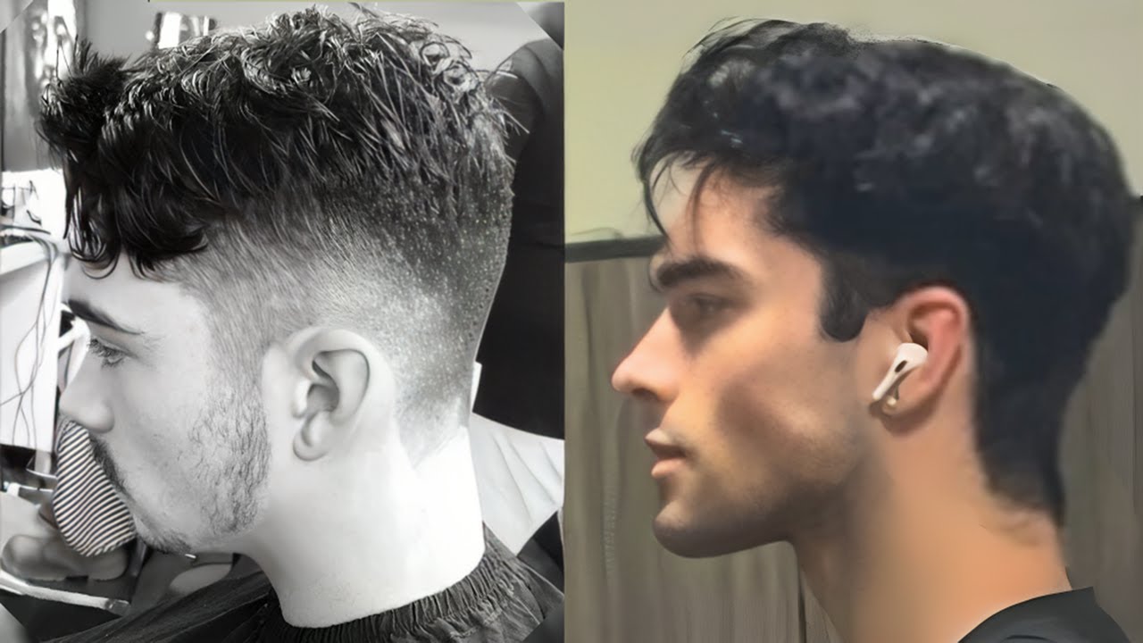 How I Fixed My Recessed Jawline (Why Mewing Isn't Working For You)