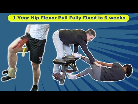Fix Groin Pulls, Adductor Strains & Hip Flexor Pain FAST (The Hidden Glute Cause & Real Fix)