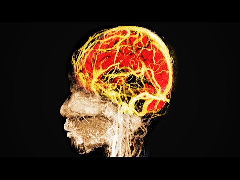 A Girl Ate 96 Gummy Edibles. This Is What Happened To Her Brain.