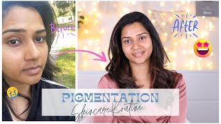 How I Controlled the Pigmentation around my mouth| Causes, Skincare, Treatment | Femirelle