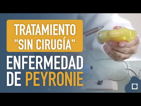 Protesi artroplastica Se è possibile sviluppare larticolazione del gomito dopo la frattura