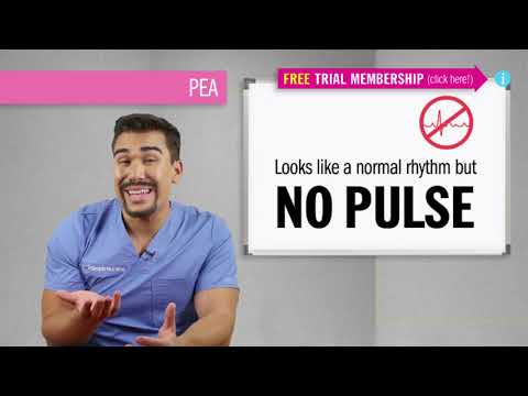 Pulseless Electrical Activity   PEA