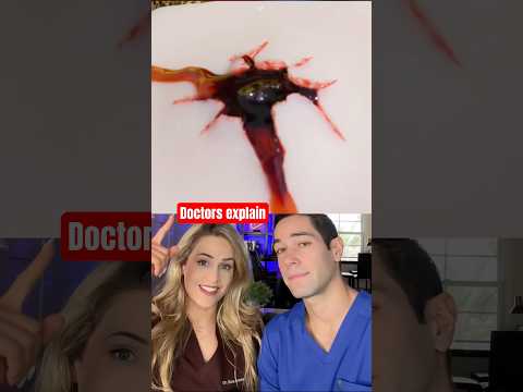 How to prevent bleeding out