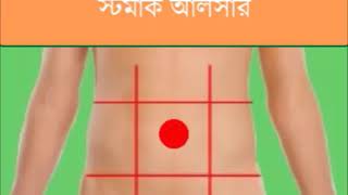 পেটের কোন অংশ কি ব্যাথার সংকেত দিচ্ছে জেনে নিন