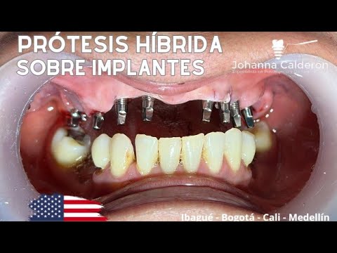 Johanna Andrea Calderón Bohorquez-41