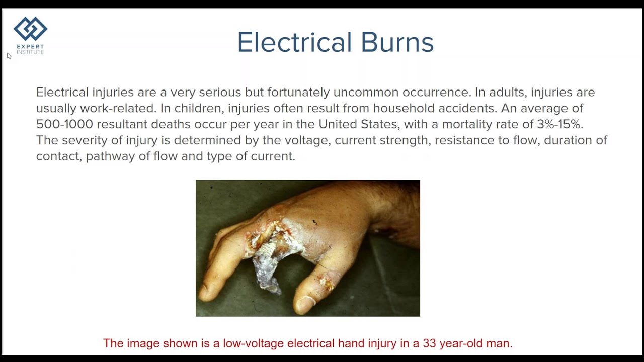 Fill out the form to watch