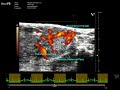 Mid-gestational Mouse Placenta